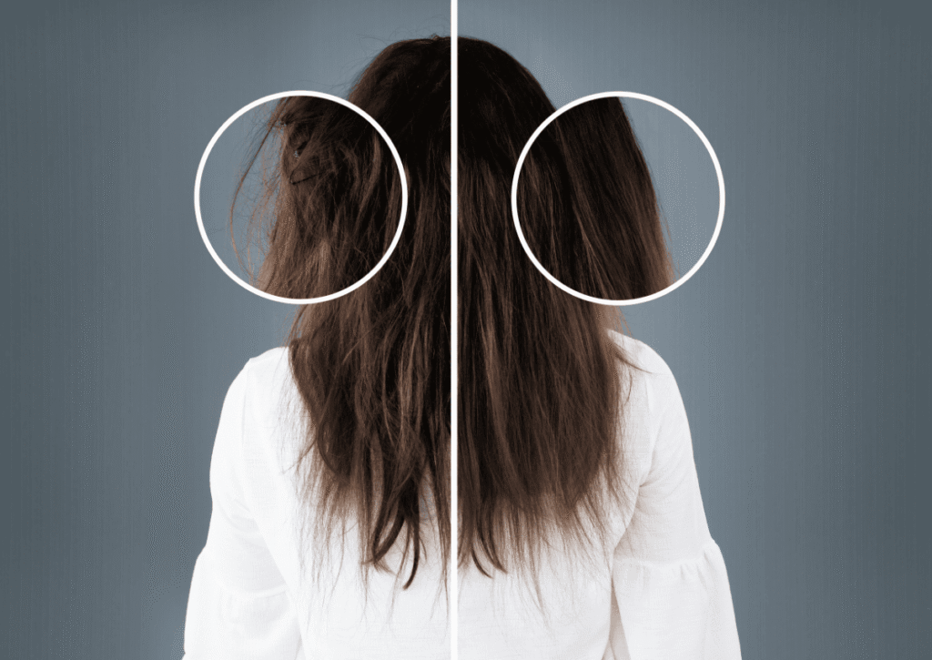 Cau truc soi toc va nhung sai lam nhieu nguoi mac phai